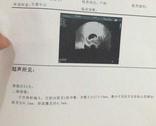 为啥香港验血检测宝宝就是合法的,做试管婴儿解冻6年前冻坯胎，“双胞胎”相