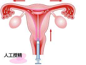 香港验血机构报告都不一样吗,人工授精和试管婴儿都属人工受孕，两者有何不