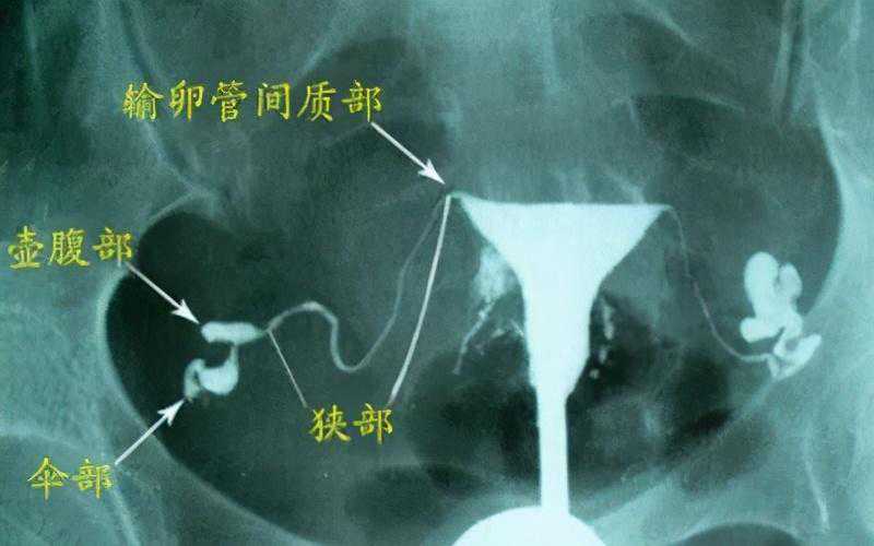 香港医院孕妇验血多少钱,试管婴儿价格费用 治疗输卵管堵塞哪家 医院