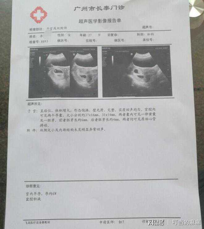 香港基因化验所准吗-香港验血查男女准确率