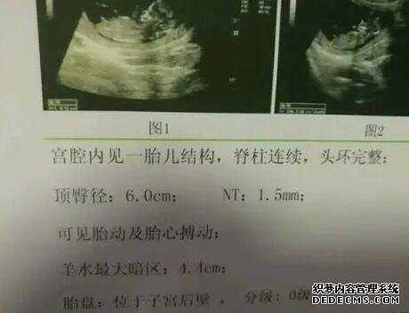 香港验血合法 打胎的多么_怀孕几周可以去香港查男女准吗_有Y染色体生女孩怎