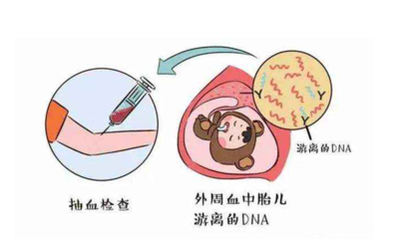 香港化验所验血哪个便宜_「必看」怀孕查性别验血，进程有惊无险