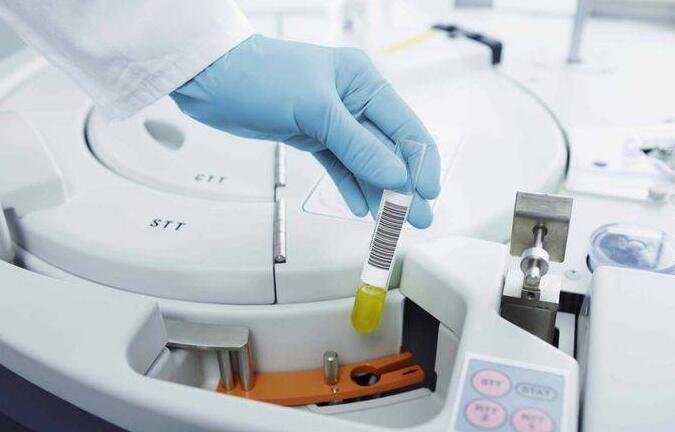 香港7周验血为什么合法_区香港诊所验血检测结果准吗_验血查男女哪个诊所准